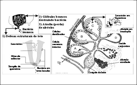 Ilustração de glândula mamária com mastite